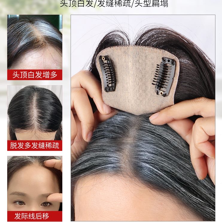 假发片女头顶蓬松增发量全真发遮白发递针隐形无痕刘海头顶假发片