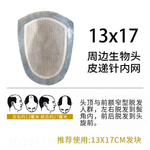 高档男士假发头顶补发男短递针真发补发生块前额发际隐线形头无痕