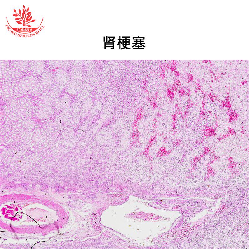 6种常见病理学组织标本切片高教医学院教学研究用显微镜标本片