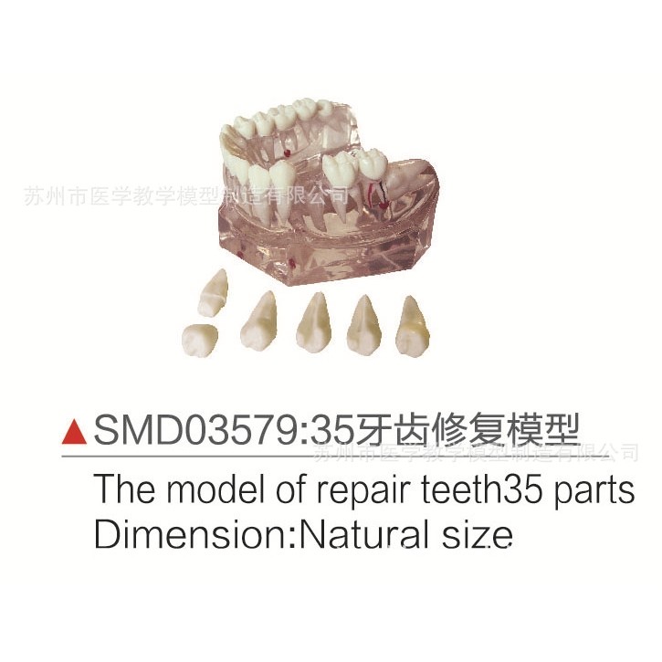 SMD03579  35牙齿修复模型,文具电教/文化用品/商务用品,教学标本/模型,淘宝优惠券,粉丝福利购,淘宝优惠卷