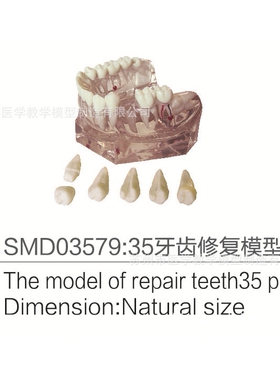 SMD03579  35牙齿修复模型