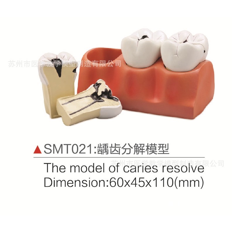 SMT021龋C分解模型,文具电教/文化用品/商务用品,教学标本/模型,淘宝优惠券,粉丝福利购,淘宝优惠卷