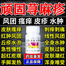 顽固性过敏荨麻疹皮肤瘙痒皮炎湿疹治疗荨麻疹非特效中成药止痒YY