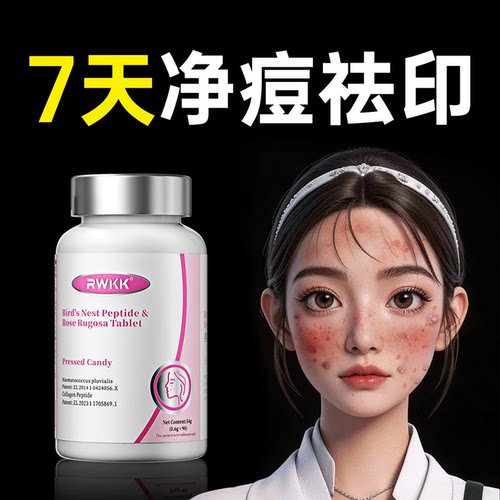 祛痘净印女性内分泌失调反复长痘调理祛痘印痘坑内服药痤疮内调