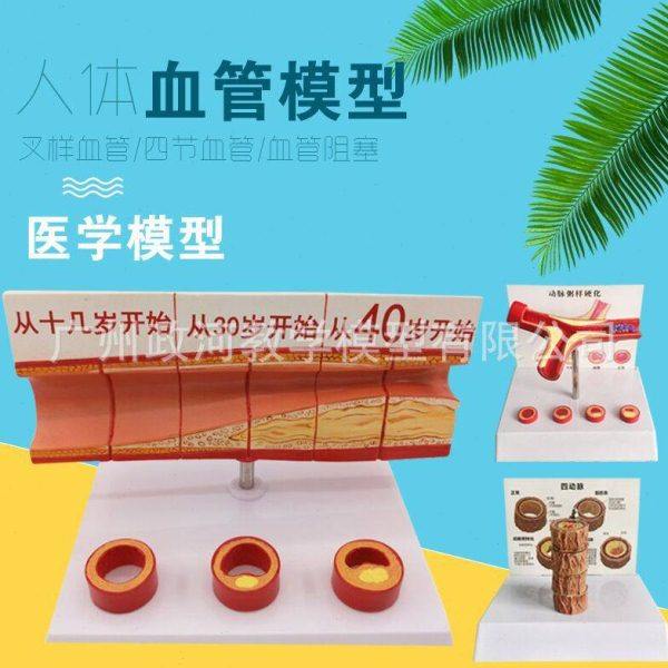 冠状动脉性 心血管动脉模型 硬化模型 老年心脏模型血栓教学模型,文具电教/文化用品/商务用品,激光笔,淘宝优惠券,粉丝福利购,淘宝优惠卷