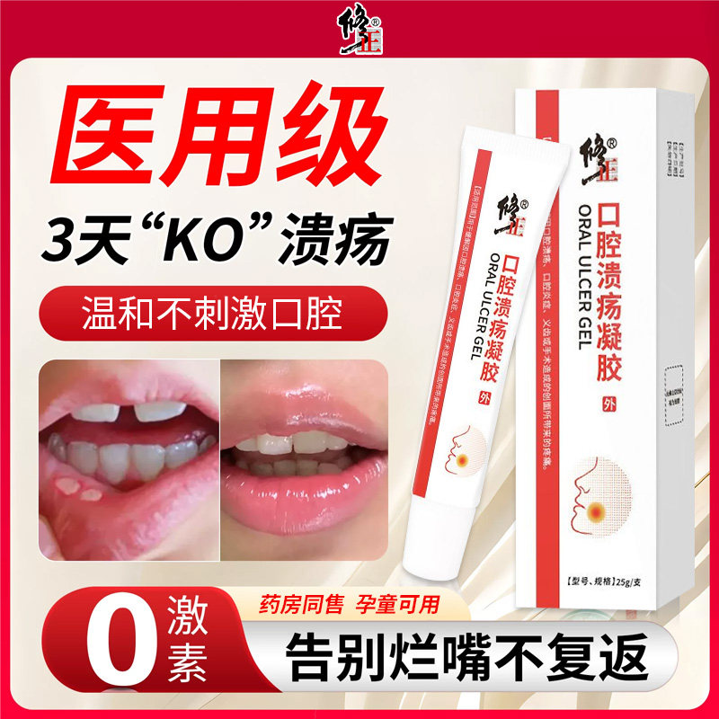 医用级口腔溃疡凝胶儿童上火口舌起泡嘴巴溃烂口疮消炎止痛一点灵