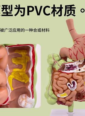 人体胃冠状剖面病解大剖放病理胃模型胃胃70549的穿孔态模型消化