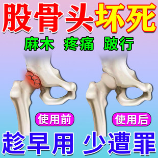 股骨头坏死特膏贴效疼痛贴专用髋关节疼痛缺血胯骨塌陷再生康复