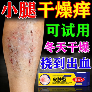 冬天腿痒小腿皮肤干燥瘙痒止痒抑菌否药老年人身上掉皮屑红疙瘩膏