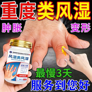 专治类风湿性关节炎痛风祛风除湿效手指变形肿大特专用膏非贴