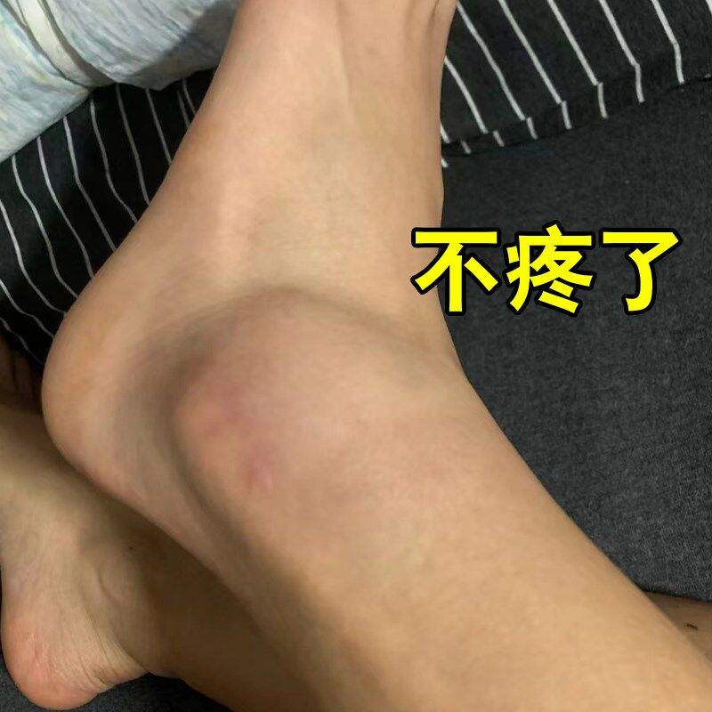 【脚脖子疼痛】肿胀脚踝关节疼麻木僵硬痛脚脖痛一动就疼
