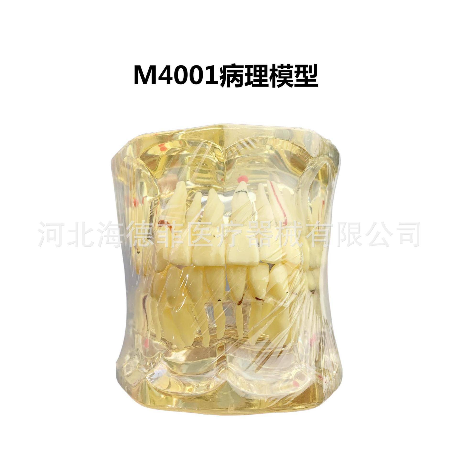 M4001牙齿模型教学模型成人病理模型