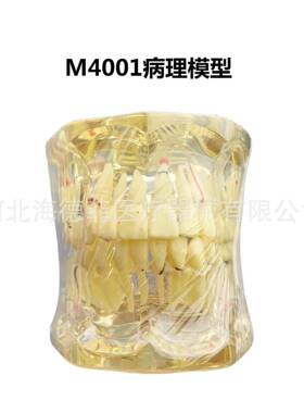 M4001牙齿模型教学模型成人病理模型