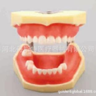 牙齿模型教学模型缺失种植下缺