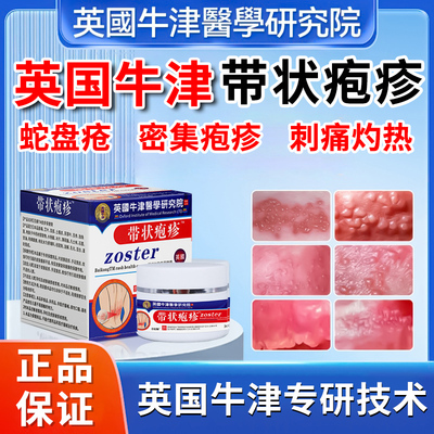 牛津带状疱疹后遗症神经痛