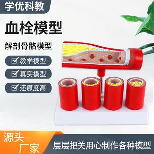 心血管动脉冠状动脉状模型老年支脉硬化形成血栓模型人体血管模型