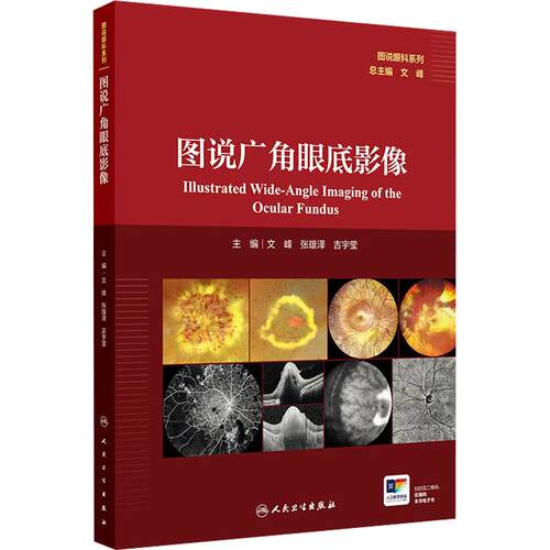 【活动促销】 图说广角眼底影像 2024-10-01 人民卫生出版社