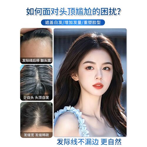 假发女片头顶补发高颅顶增发量遮白发全真人发递针八字刘海假发片
