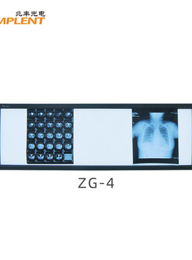 批发胶片灯兆丰智能调光型超高亮四联LED观片灯ZG-4阅片灯