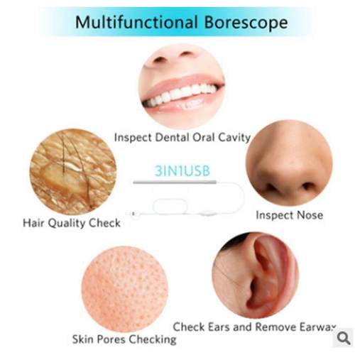 130W像素可视耳勺窥道HY医用内镜高清挖耳耳窥鼻儿耳童看牙安全内