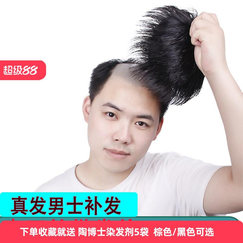 男士补发片假发套头顶补发前额秃顶补发垫接发翻盖假发真发发块