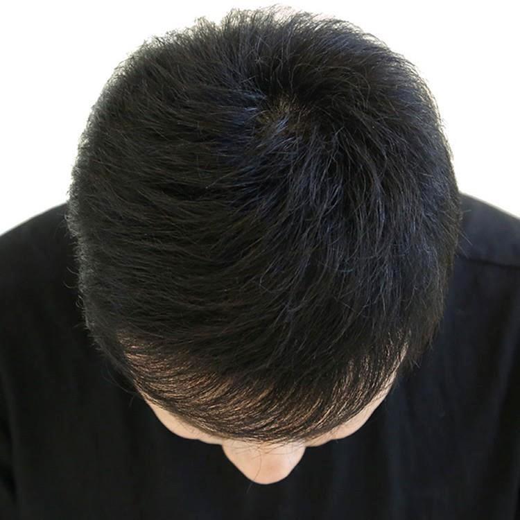 假发男士短发中老年男士发套真发全发套短发头套自然光透气假发套