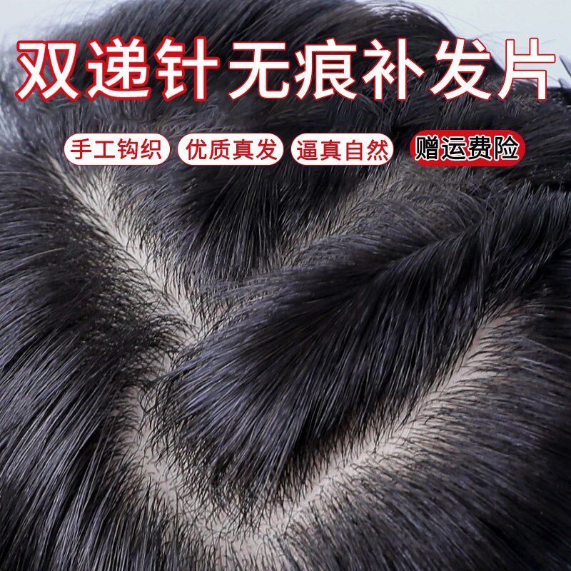 双递针假发片头顶补发片女u真发遮白发自然蓬松增发量隐形无痕补