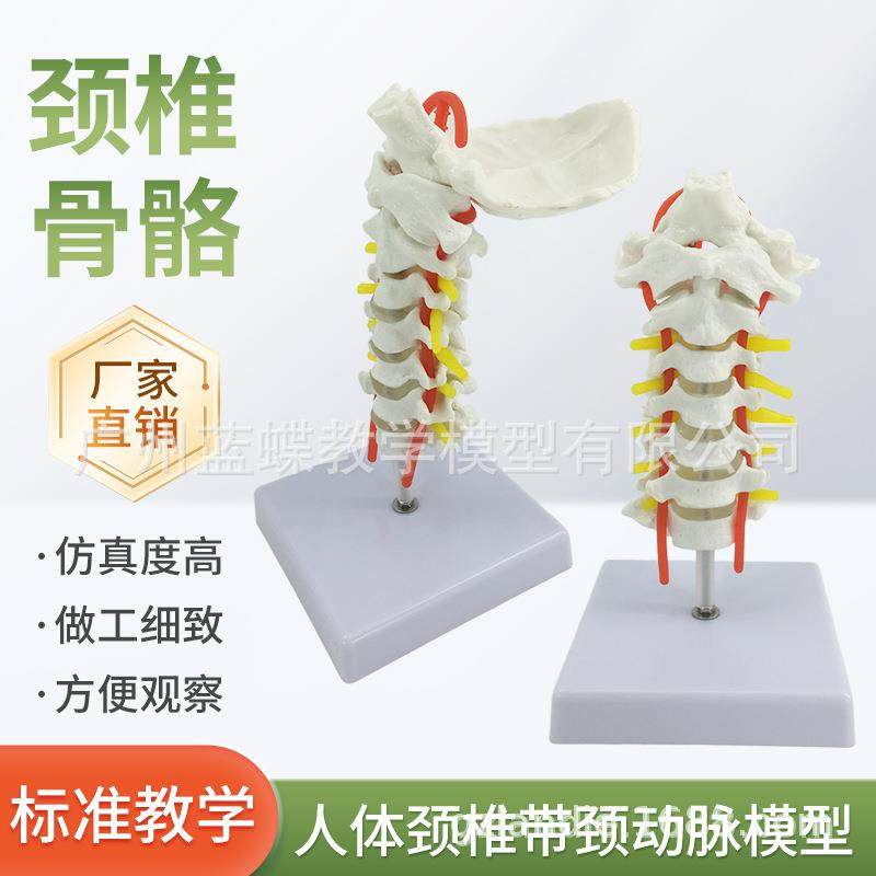 自然大人体颈椎带颈动脉后枕骨椎间盘与神经骨科模型 颈椎 枕骨