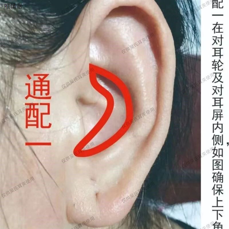 32只装吴氏耳穴夹夹子套装不锈钢弹簧主体亚光防滑家用