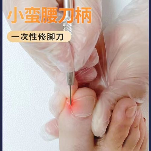 一次性修脚刀嵌甲甲沟专用工具专用足浴修脚技师家庭修甲刀九制刀