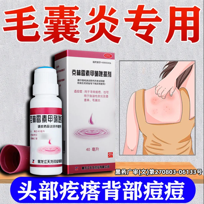 克林霉素甲硝唑搽剂治疗毛囊炎特效期药膏皮炎止痒皮肤真菌感染XY
