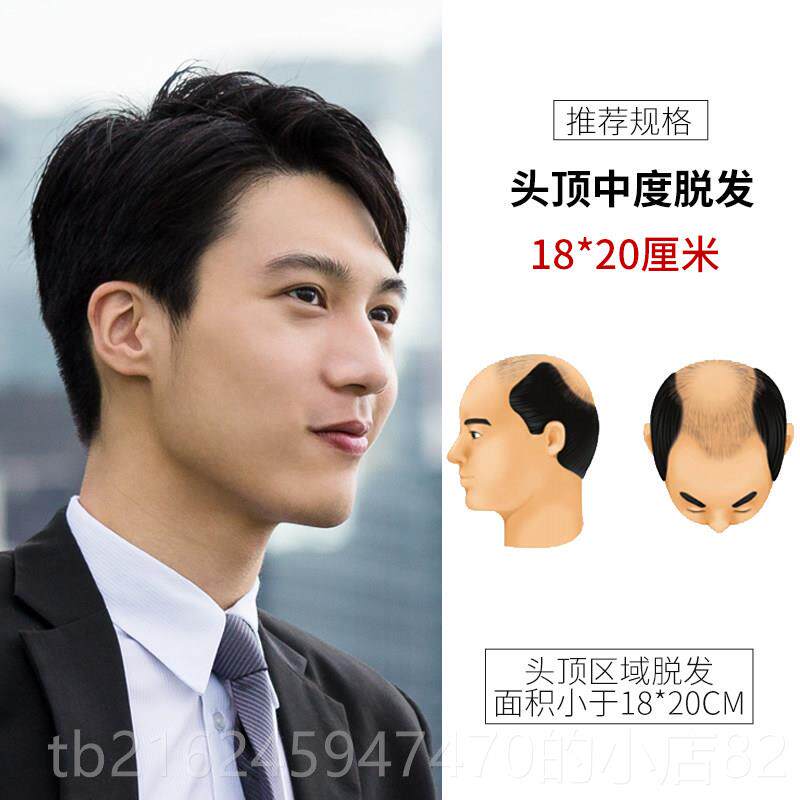 高档男假短发帅气韩版头顶补发片偏分秃年顶士前额中老男式真发发