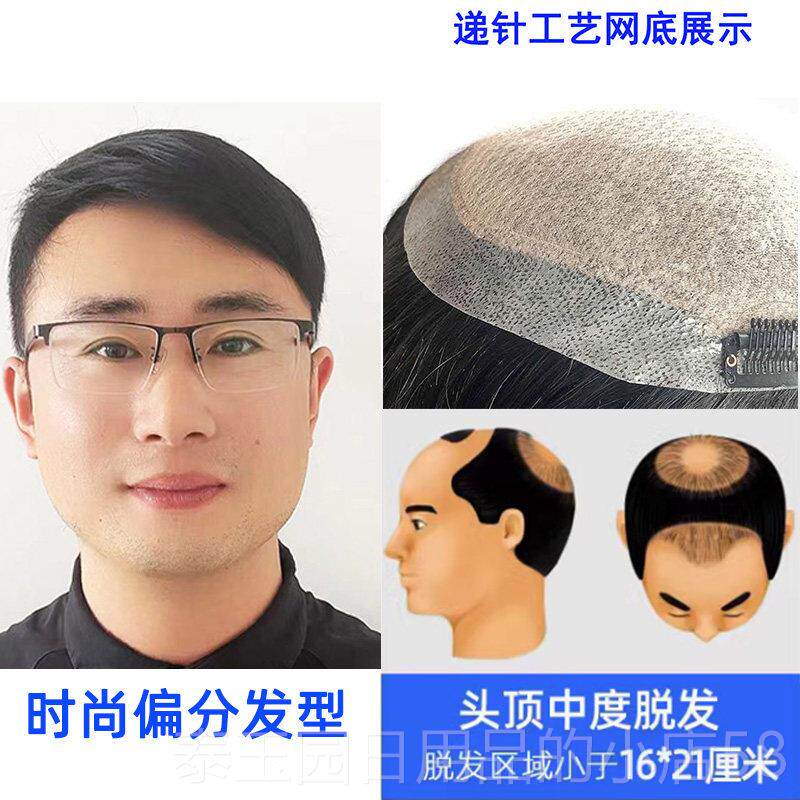 高档假发男补短发男士头顶真发浏海织发补额发片块脱发前手自然发