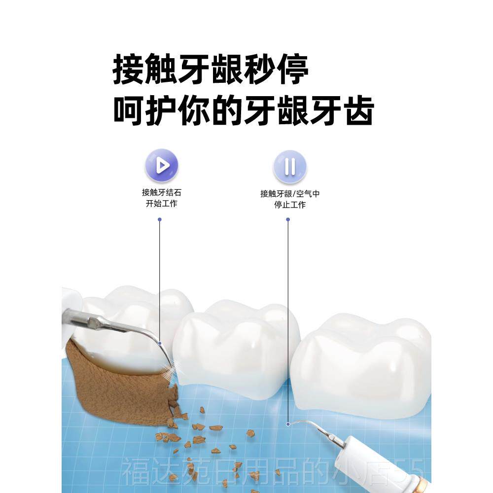 高档趣健乐洁器超牙声波洁牙器去除牙冲牙石牙垢牙器家用洗牙器齿