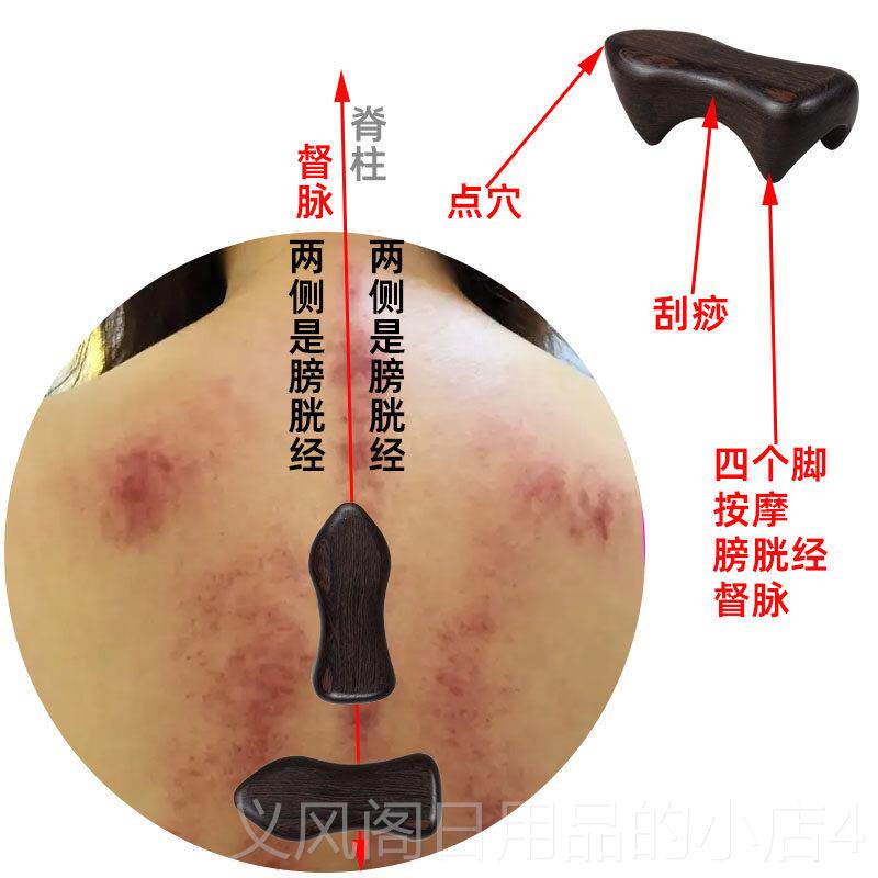 正品经络摩狗推拿按按工具背部经络疏按摩器摩动力虎通脊柱按摩器