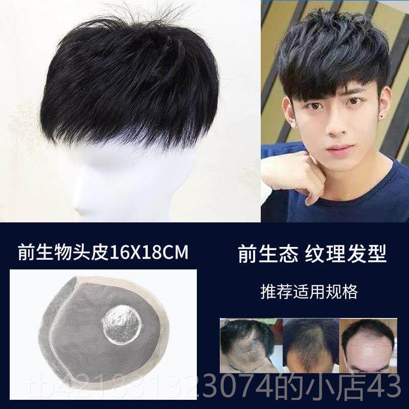 高档织发补假发男士痕头顶发块真发假发片秃顶无隐发形前额地中短图片