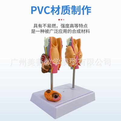 体人病理甲状腺模型甲亢甲低内分泌统学解剖983甲状腺系喉头医教