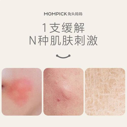 兔头妈妈紫草膏双紫倍护膏蚊虫叮咬止类舒缓2g儿童舒缓棒青草膏