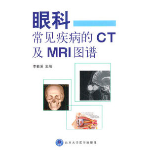 正版新书 眼科常见疾病的CT及MRI图谱 9787565908392 北京大学医学出版社有限公司