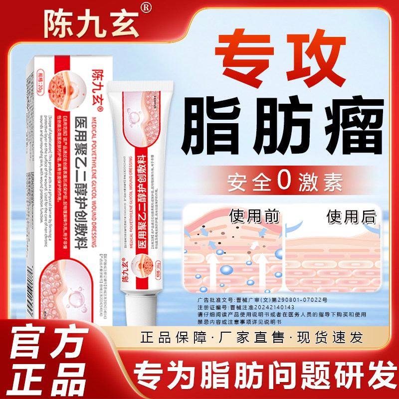 陈九玄医用聚乙二醇脂肪瘤敷料