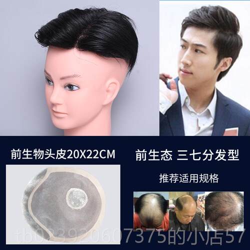 正品织发补发假发士顶短发块真中发假发片秃头顶无痕隐形男前额地