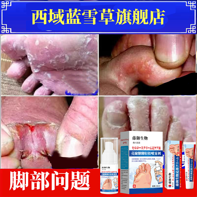 喷脚王喷剂+软膏抑菌草本护理