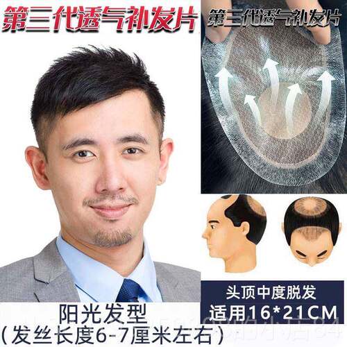 新款米短补尔补发男发假发男顶士中年头补发真人发丝织发块秃顶补