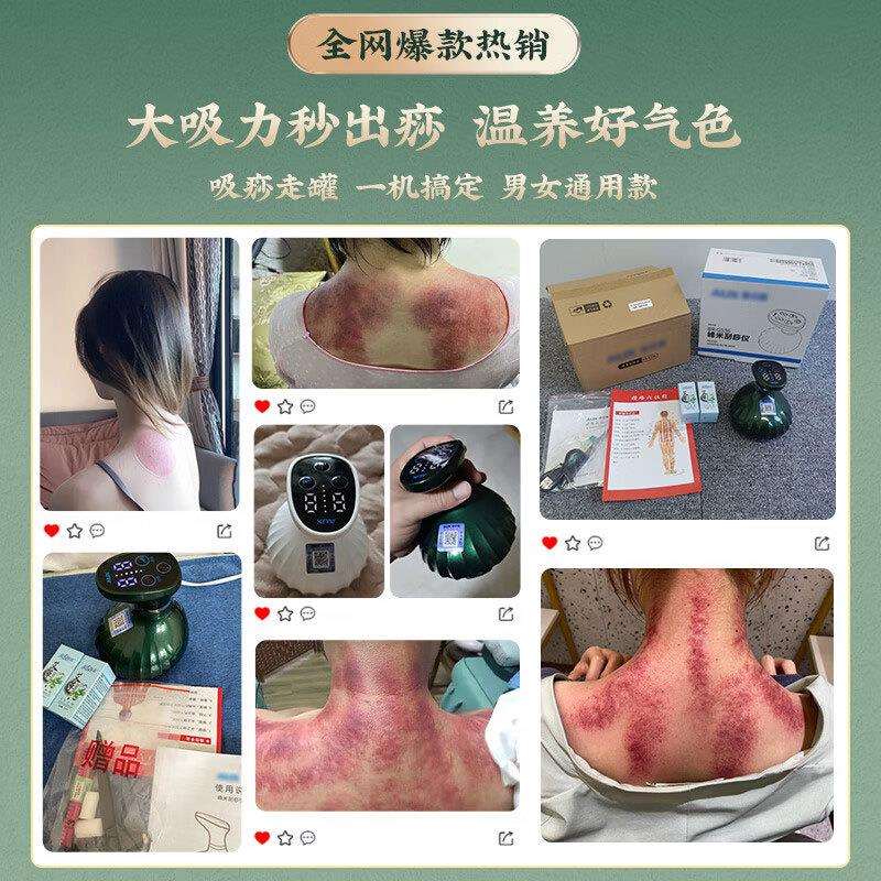 电动刮痧仪拔罐电动经络刷筋疗仪器吸痧器通用全身家用按摩刮痧板