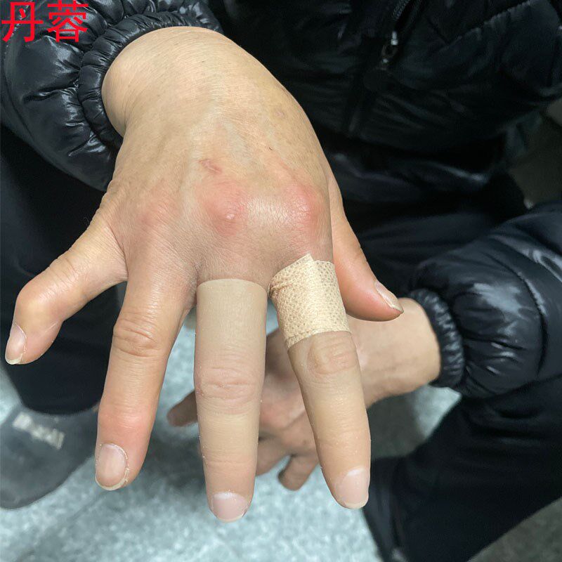 取模定制高端硅胶手指量身定制假肢单色普甲双色硬甲残疾义肢