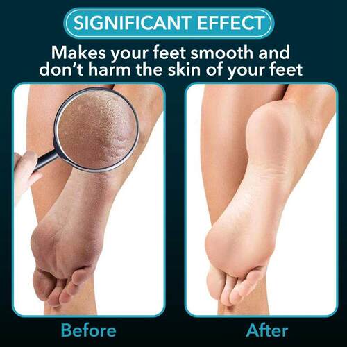 2Pc Glass Foot File Nail Buffer Set Callus Remover Heel Dead