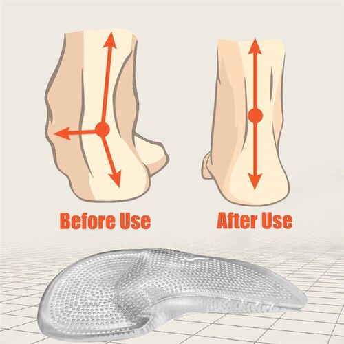 Silicone Gel Orthopedic Insoles for Shoes Women Flat Feet Ar