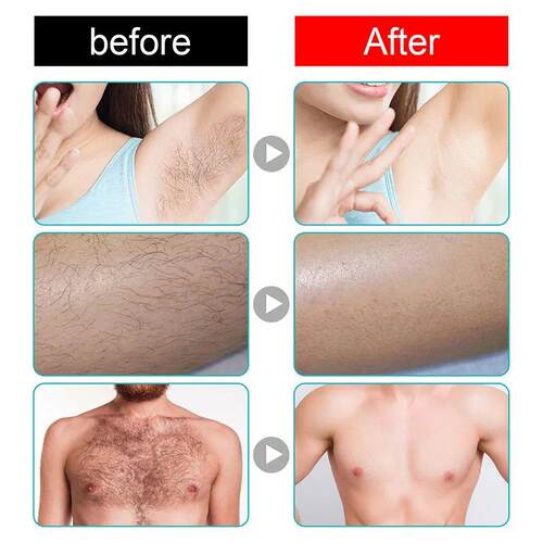 Permanent Hair Removal Cream Painless Intimate Parts Legs Bo