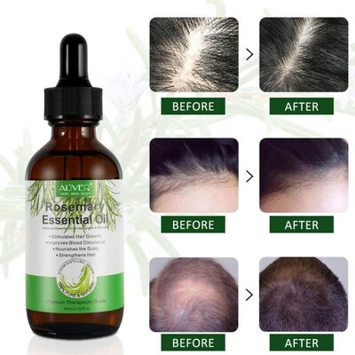 Rosemary Hair Care Essential Oil Nourish Hair Roots Hair Gro