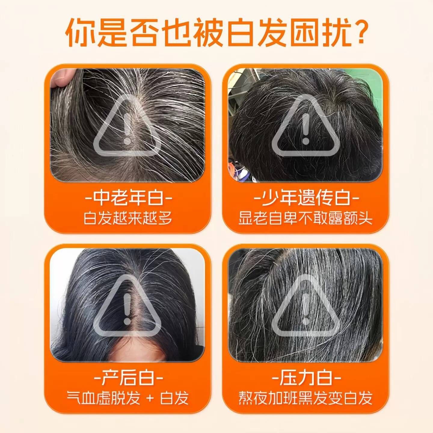 奥博士白多维素维多种生素片黑发少中老年掉发头发稀呵护毛发囊RS